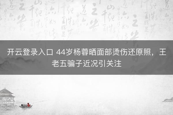 开云登录入口 44岁杨蓉晒面部烫伤还原照，王老五骗子近况引关注